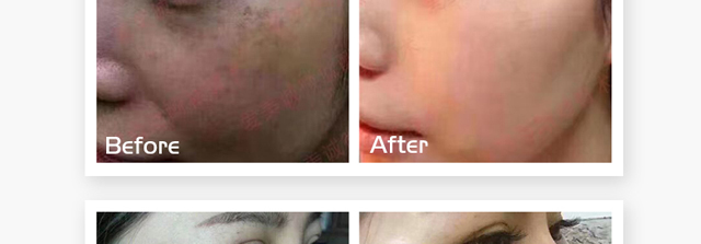 ΢�ķ����oԭҺ