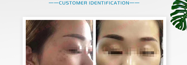 ΢�ķ����oԭҺ