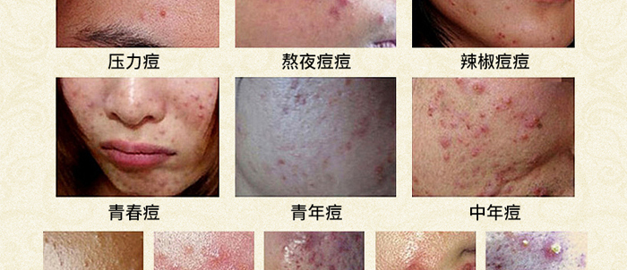 �琂�òݱ�ֲ����M��