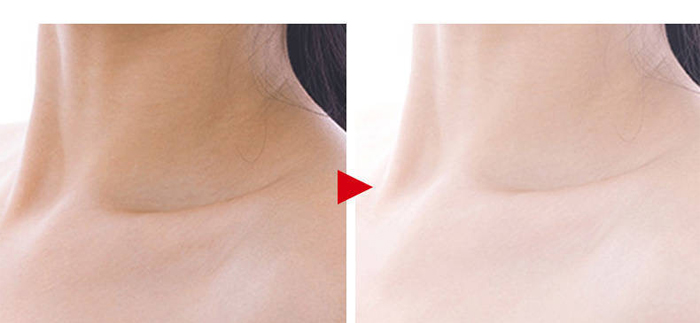 ��������˪